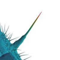 La "Solsbury Hill" di Lou 2 Peter Gabriel - and i'll scratch yours
